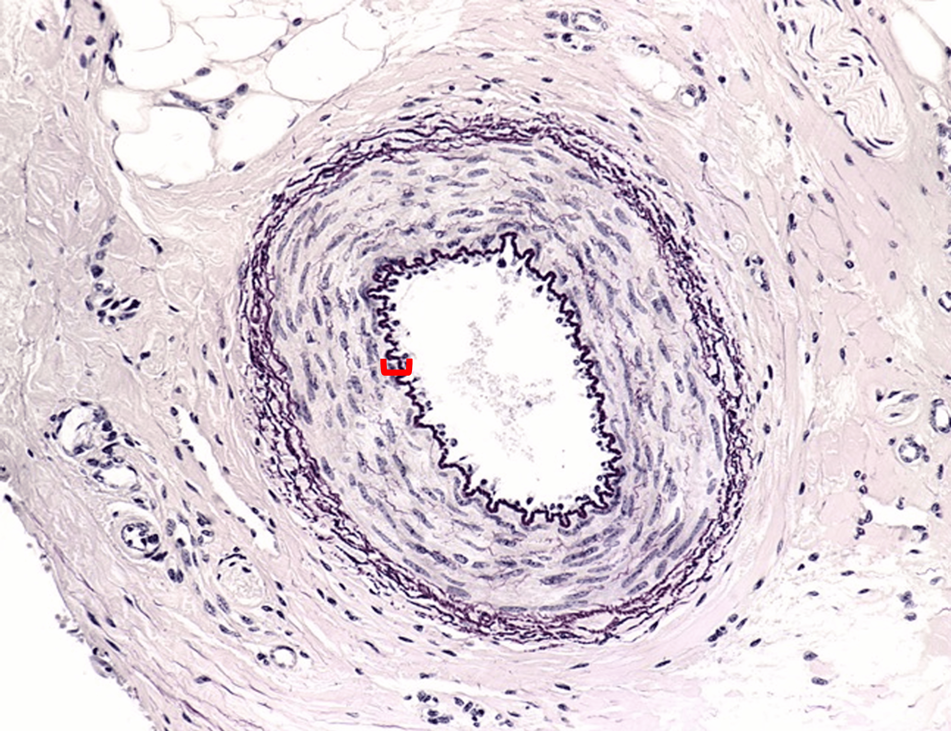 term image