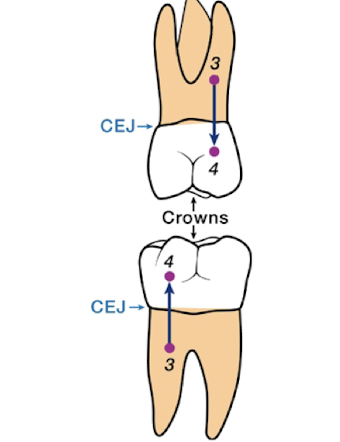 <p>Toward the crown of the tooth</p>