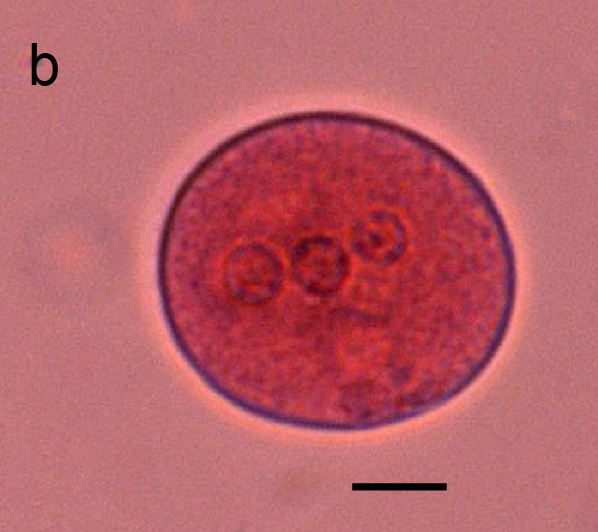 <p><10 um, 1, 2 or 4 nuclei. “Small race” E. histolytica (even PC, central karyosome, chromatoidal bars)</p>