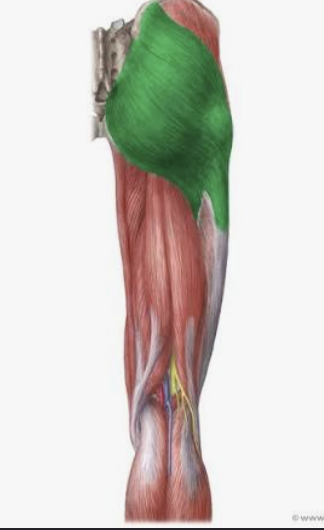 <p>Which muscle is this?</p>