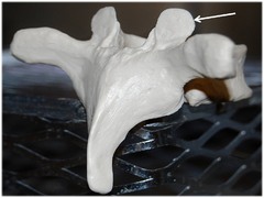 <p>Name this specific part of the thoracic vertebra. include directional term.</p>
