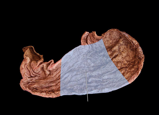 <p><span>Identify the highlighted digestive system structure.</span></p><p> </p><p>cardia</p><p> </p><p>fundus</p><p> </p><p>pylorus</p><p> </p><p>body</p>