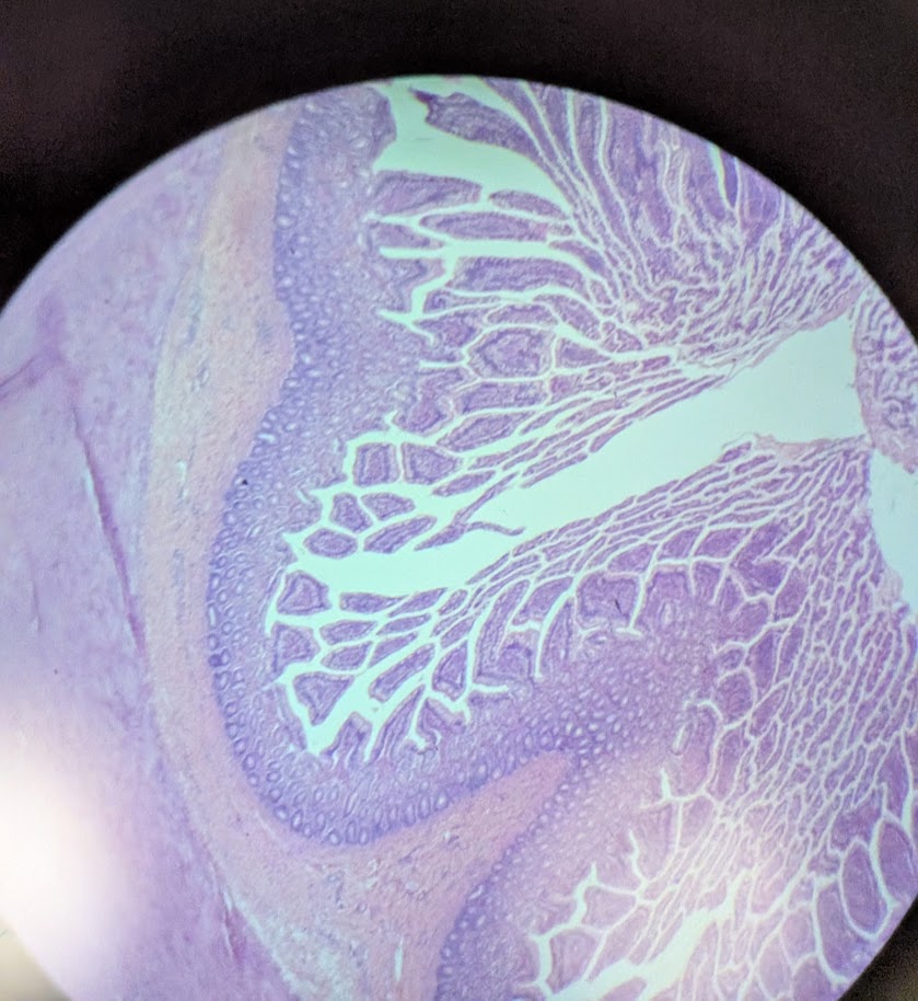 <p>Where in the body is this</p>