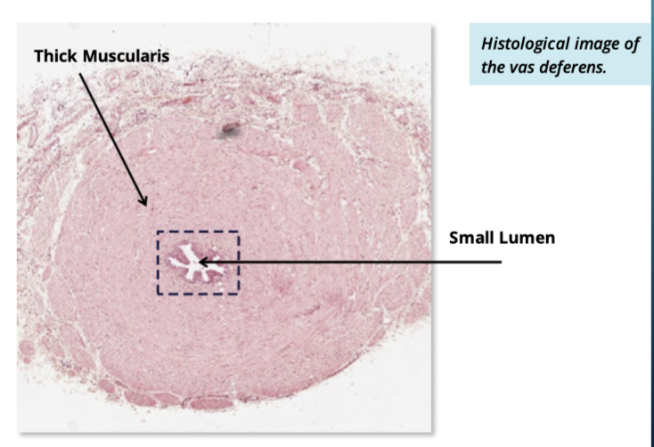 <p><span>Small lumen + thick smooth muscle layer.</span></p>