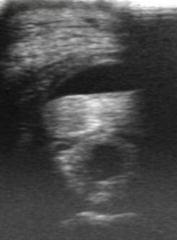 <p>What are the things you assess when looking at the integrity of a tendon on U/S?</p>