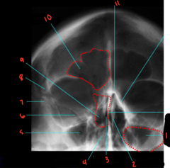 <p>What sinus is labeled 9?</p>