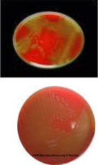 <p>Does Staphylococcus epidermidis hemolyze blood?</p>