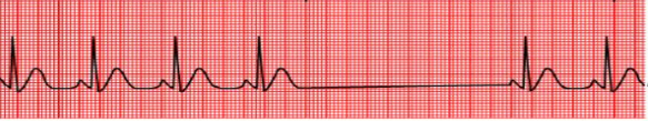 <p>what waveform is this</p>