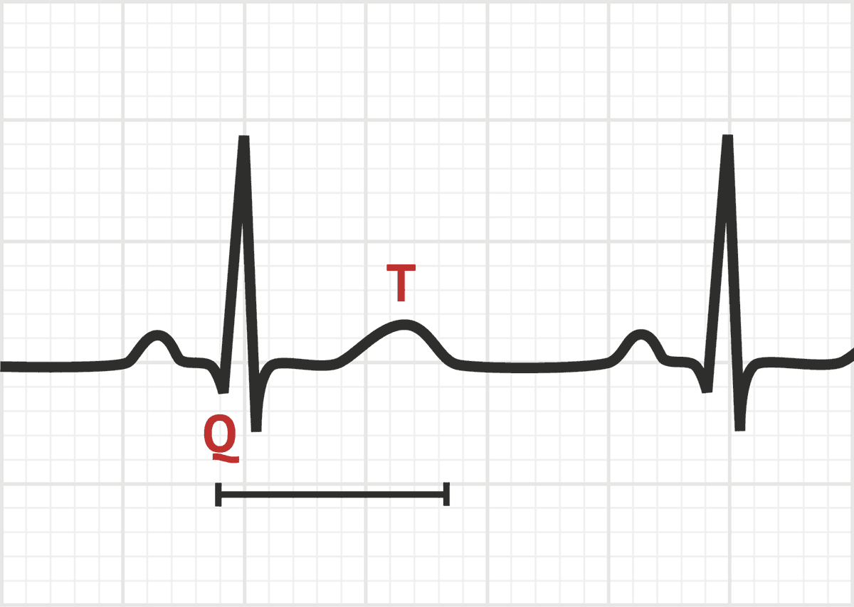 <p>last interval</p><p>Total ventricular depolarization + repolarization</p><p>time from beginning of QRS complex that represents ventricular depolarization to the end of the T wave, representing ventricular repolarizaion</p>