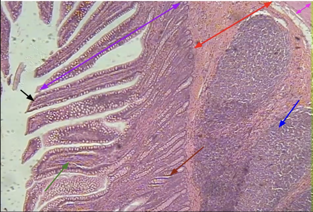 <p>What organ is this? Identify each arrow</p><p>What are the small circles seen in structure indicated by the purple arrow?</p>