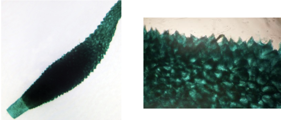 <p>What type of sponge is this? Is it simple, intermediate or complex?</p>