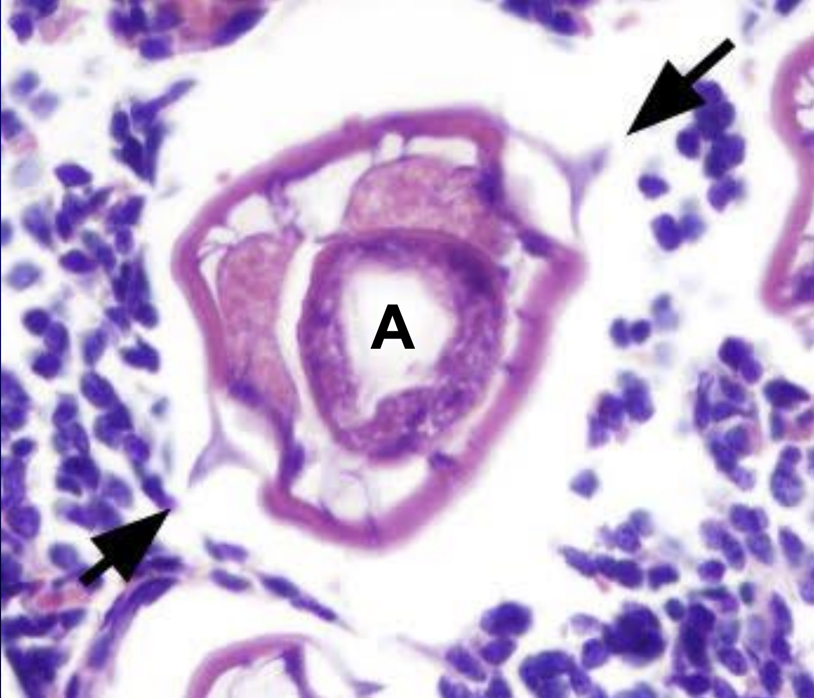 <p>what structure is labeled A (ignore black arrows) </p>