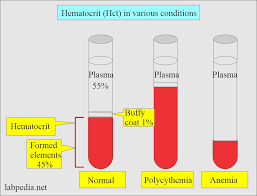 <p>percentage of erythrocytes in whole blood</p><p>– Adult females</p><p>• 38-46%</p><p>– Adult males</p><p>• 40-54%</p><p>The difference is primarily due to <strong>hormones</strong>, especially <strong>testosterone</strong>, which <strong>stimulates red blood cell production</strong>, while <strong>estrogen tends to suppress it</strong>. Men also have <strong>greater muscle mass and oxygen demand</strong>, and women experience <strong>menstrual blood loss</strong></p>