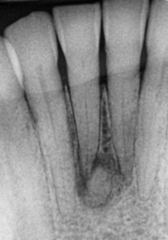 <p>describe the appearance of the lesion:</p>