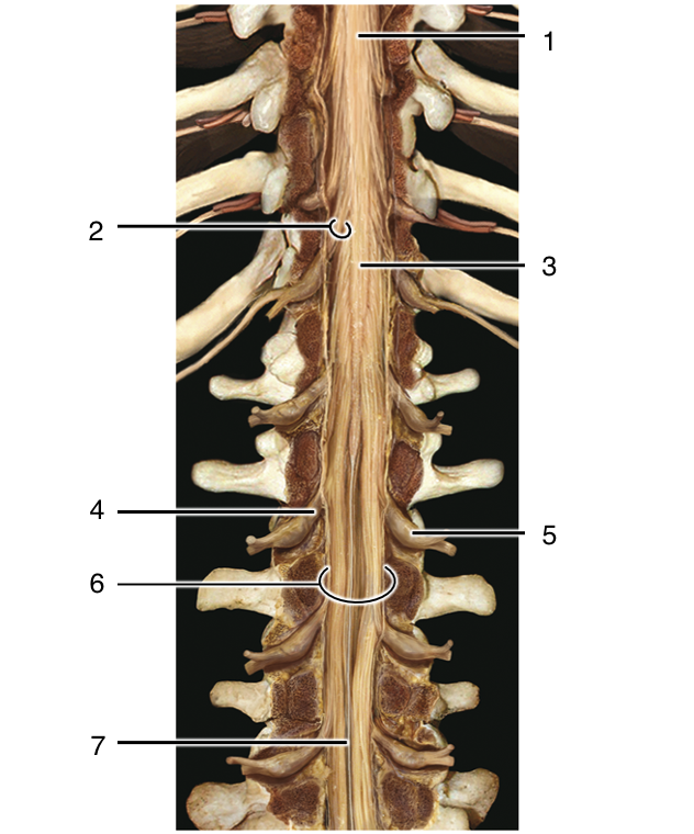 <p>ID 5</p>