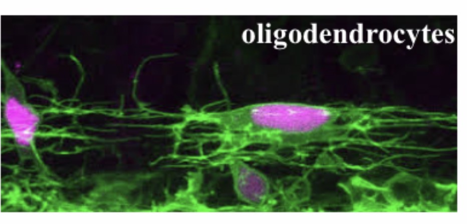<p>Oligodendrocyte</p>