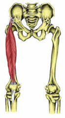 <p>anterior inferior iliac spine,</p><p>ilium superior to acetabulum</p>