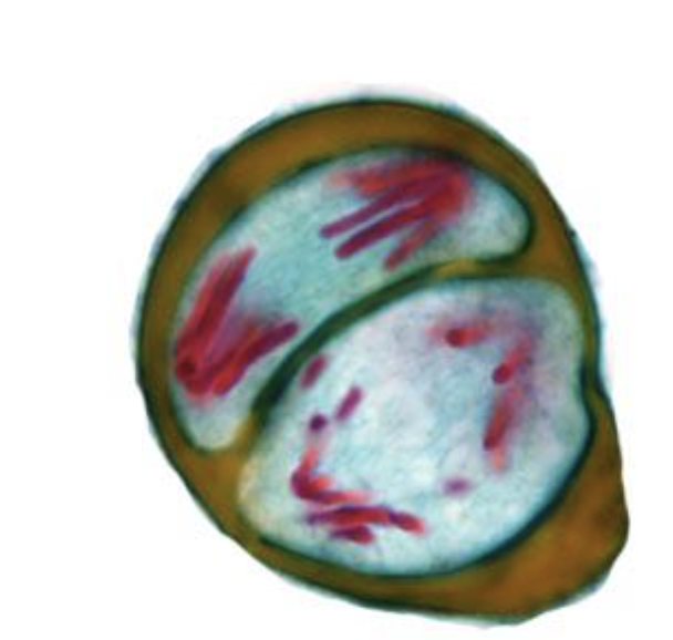 <p>chromatids are getting pulled away by spindle fibers</p>