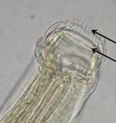 <p>small sensory organs located on the cuticle that act as mechanoreceptors and chemoreceptors detecting touch, water currents, and chemicals</p>