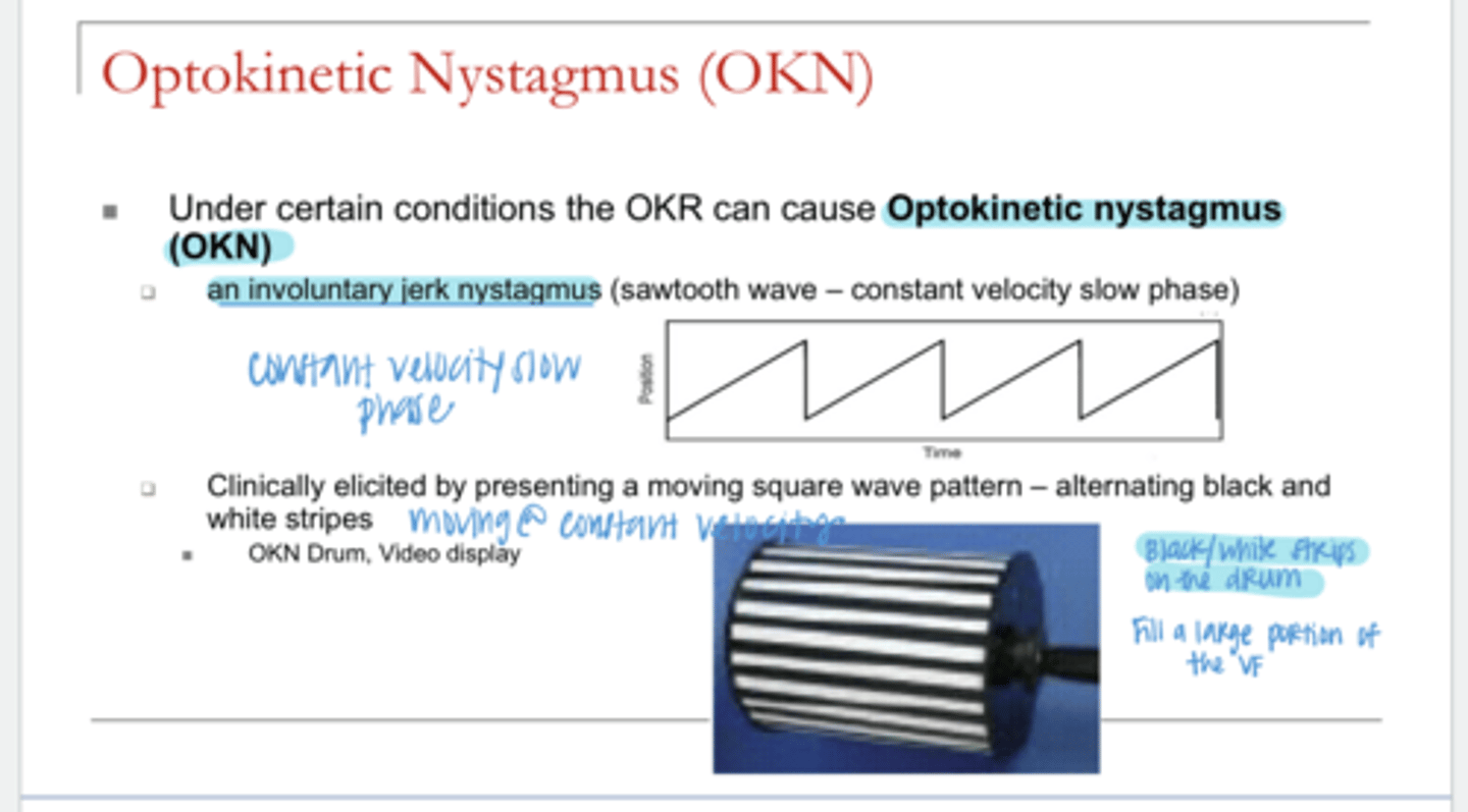 <p>How is OKN elicited?</p>