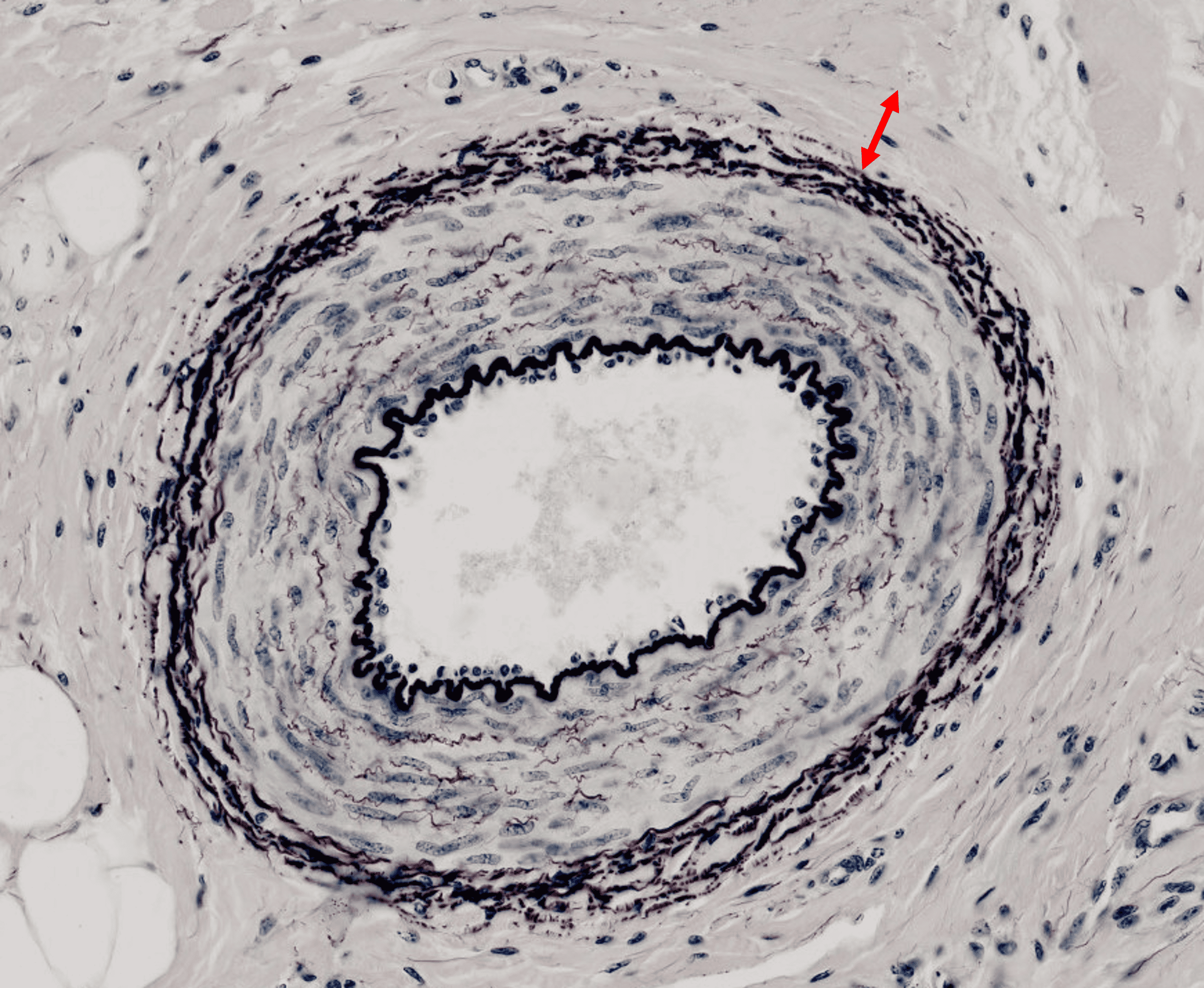 term image