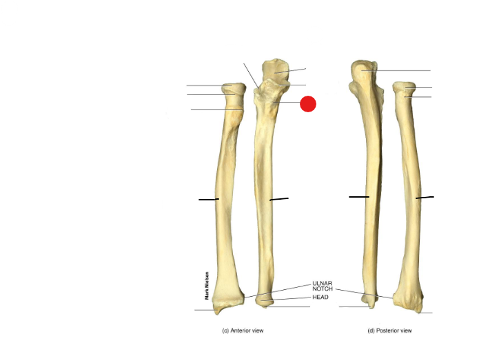 <p>Identify the structure pinned</p>