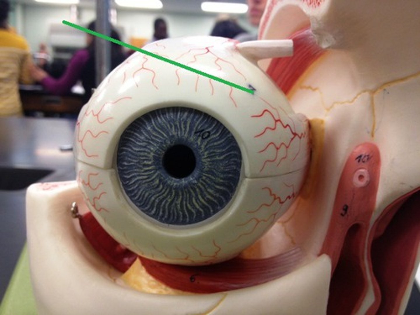 <p>White part of eye formed from dense connective tissue </p>