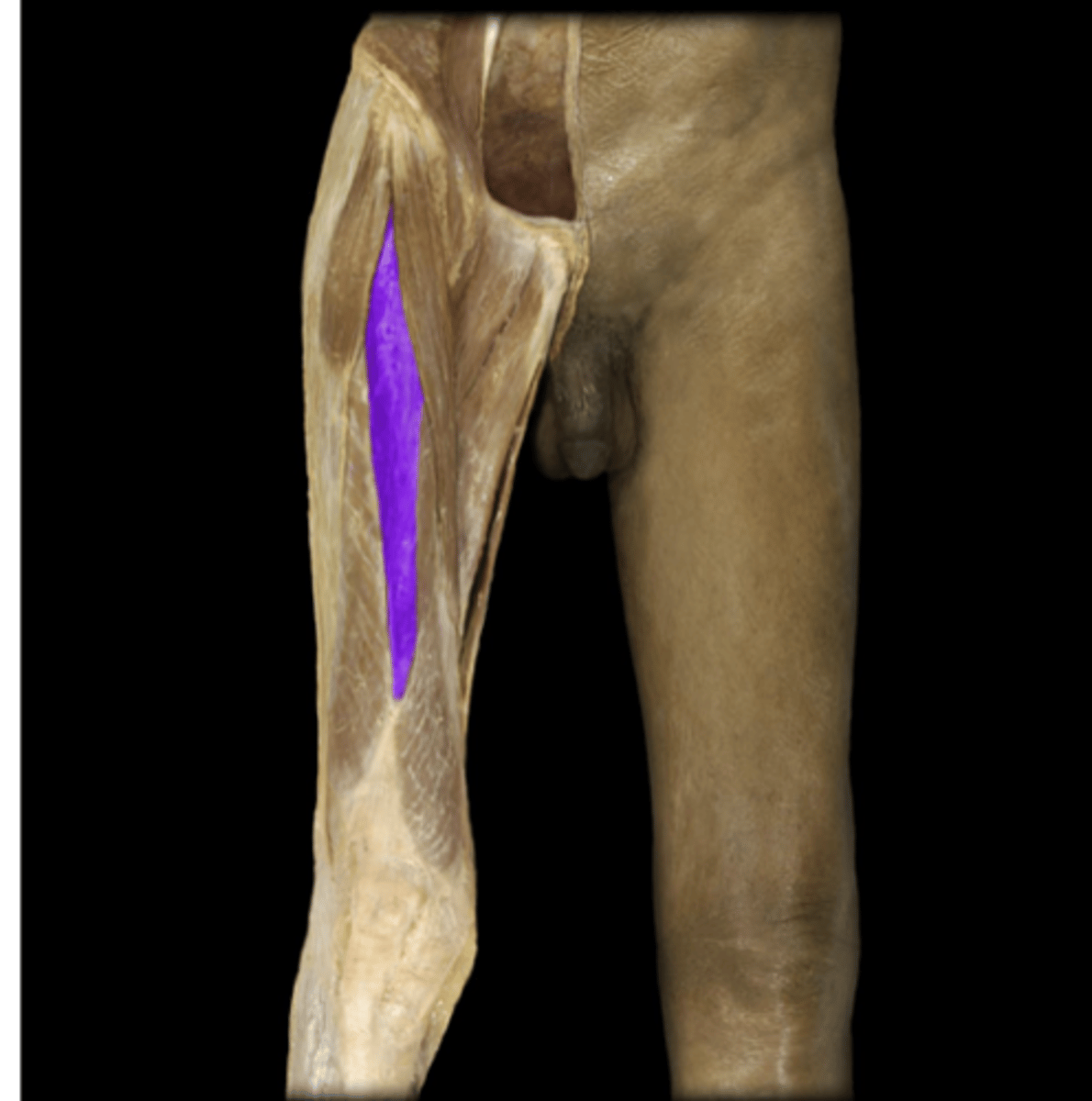 <p>What muscle is indicated in purple?...</p>