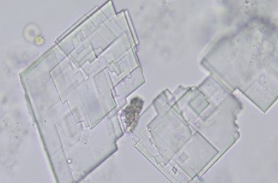 <p>what crystal; acid or alk?</p>