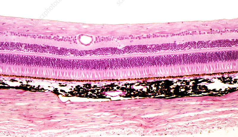 <p>Identify the labeled structure in the eye:</p>