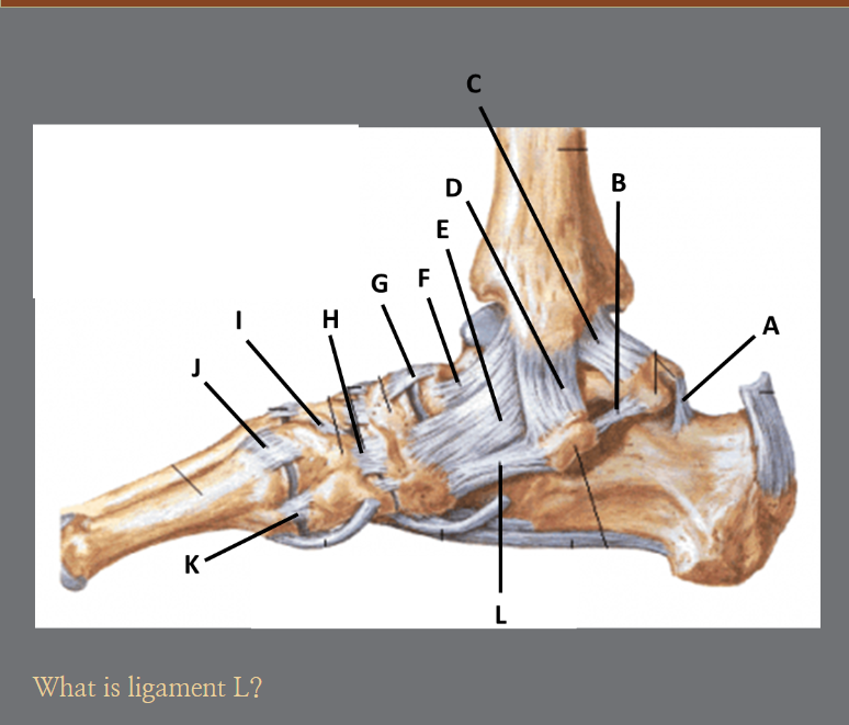 <p>L?</p>