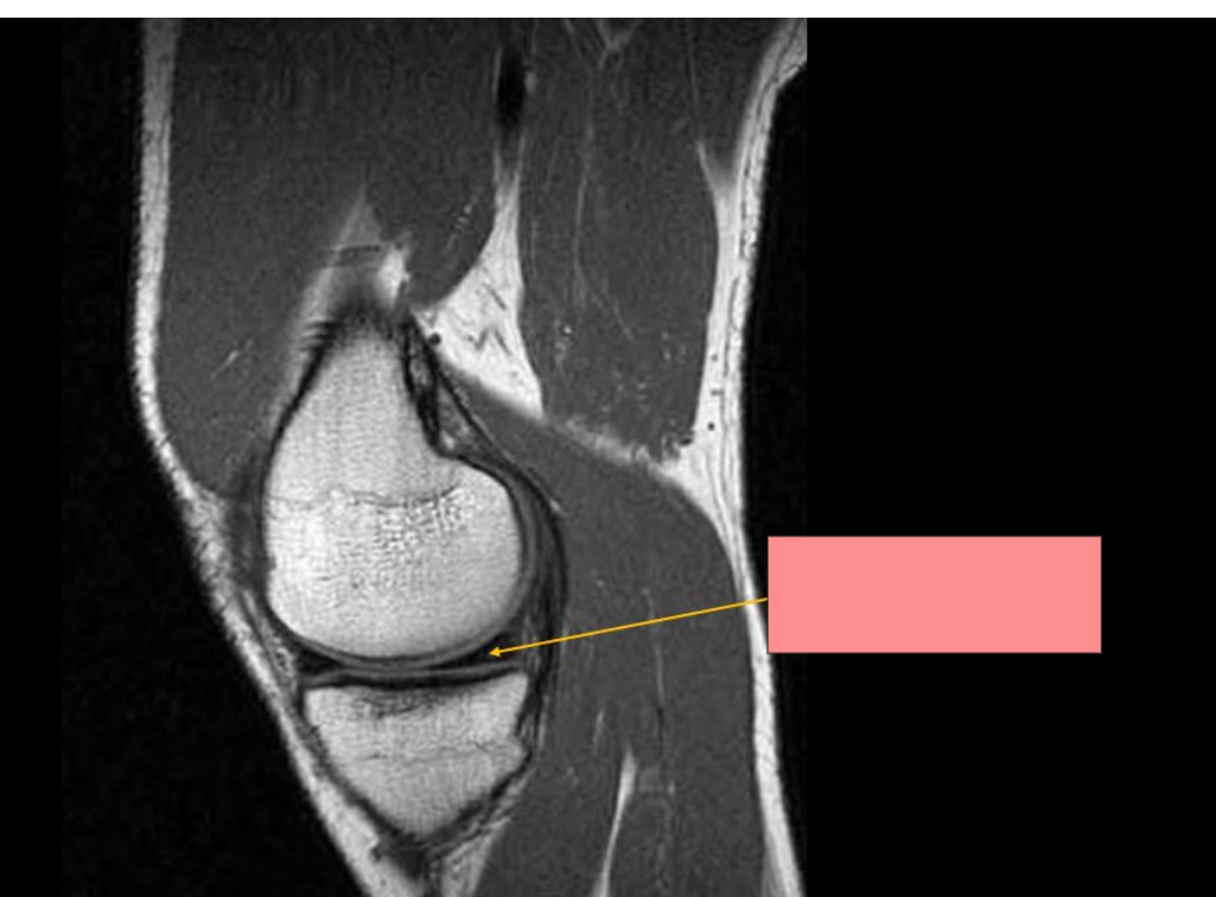 <p>Identify the structure </p>