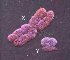<p>A nuclear chromosome passed down through the male line. Does not undergo crossing-over. It can be used to compare the relatedness of extant species and extinct species.</p>