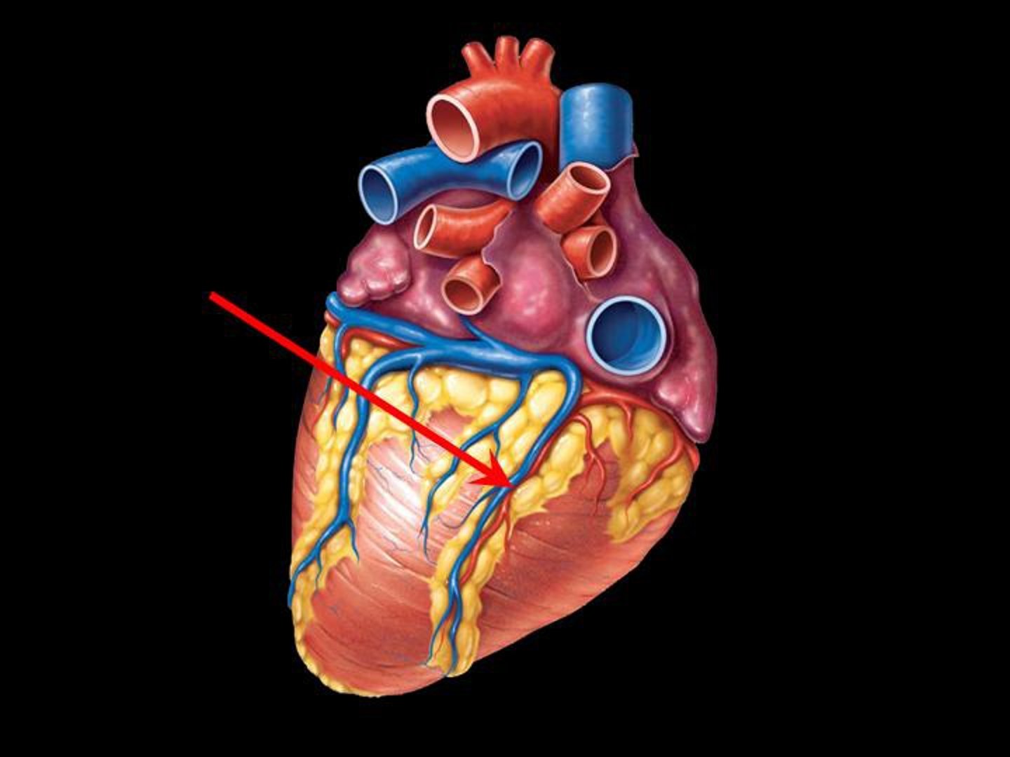 <p>Vein running in the posterior interventricular sulcus, draining the posterior heart.</p>