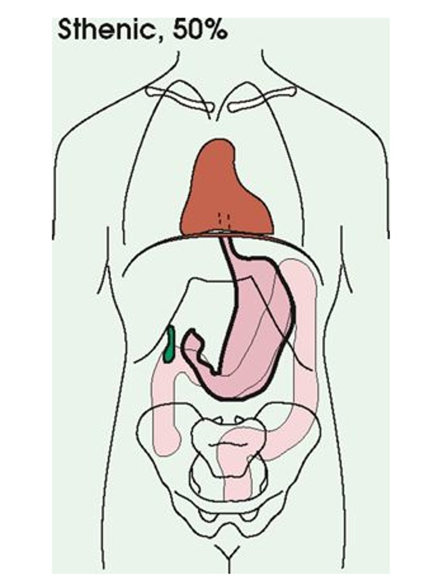 <p>Average body habitus (50%)</p>