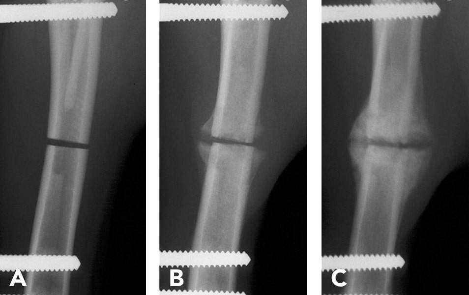 <p>Rate of healing </p>