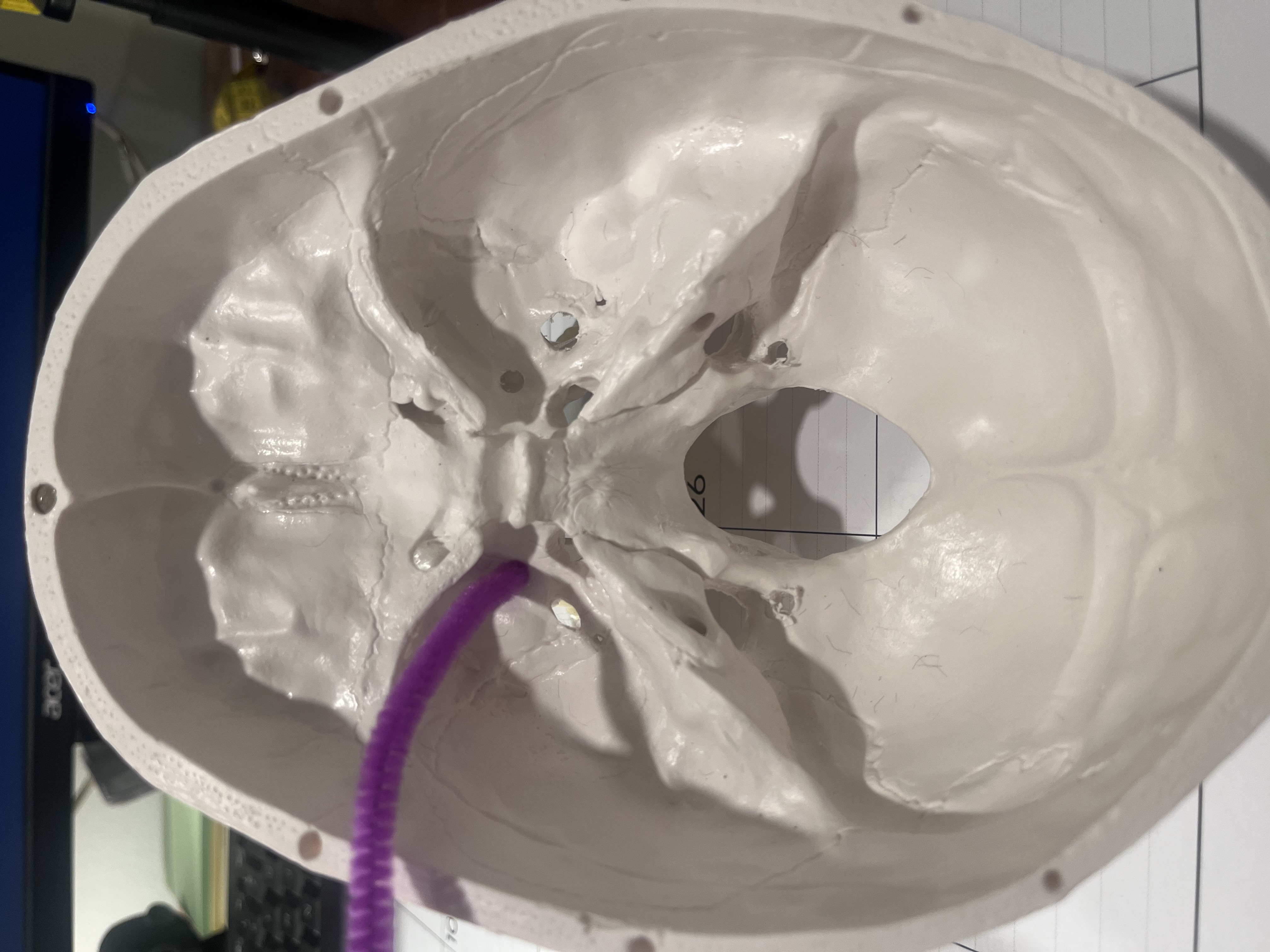 <p>What cranial nerve(s) are represented by the purple pipe cleaner?</p>
