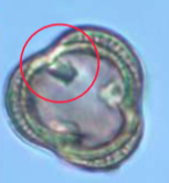 <p>Identify the circled aperture</p>