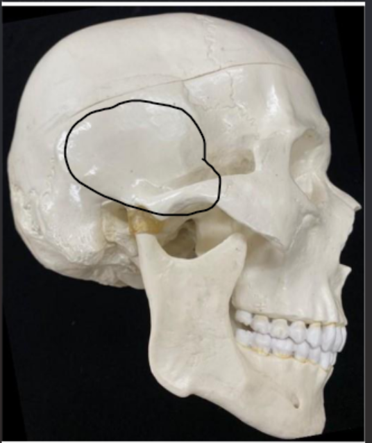 <p>What bone is this?</p>