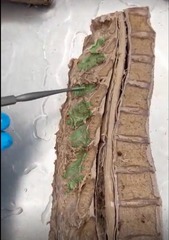 <p>Name the ligament</p>