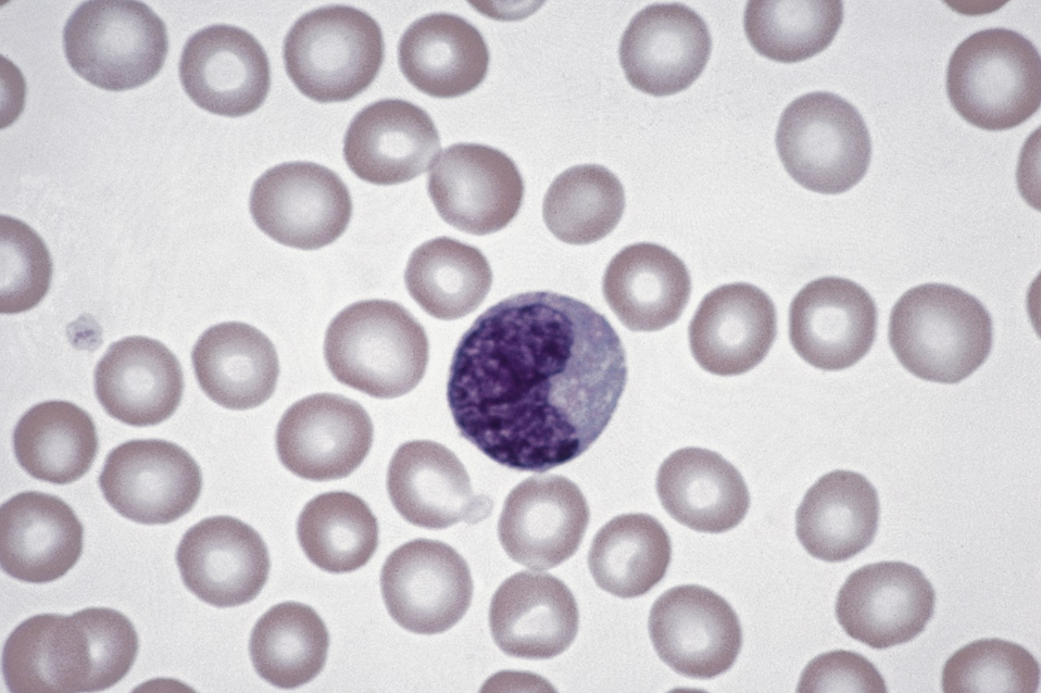 <p>ID white blood cells</p>