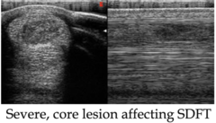 <p>What is U/S used for when diagnosis a tendon or ligament injury?</p>