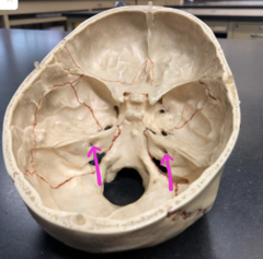 <p>Inside the petrous part</p>