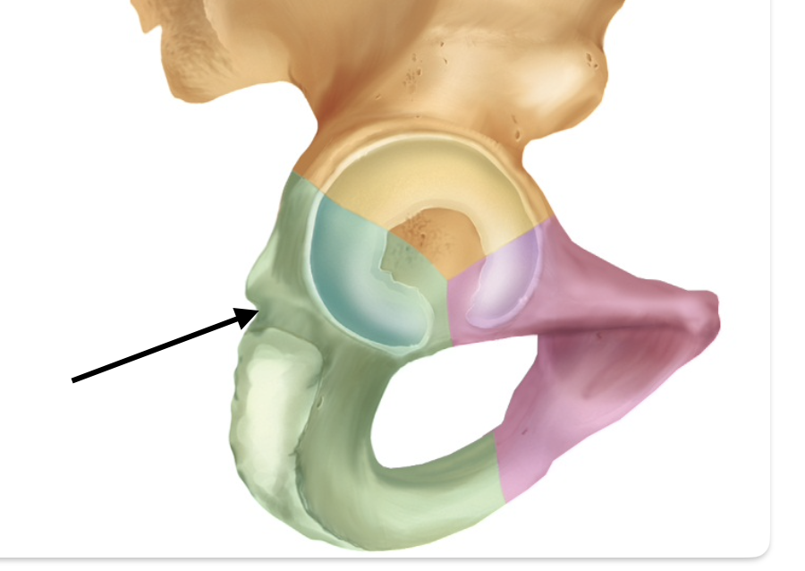 <p>Identify the bone/anatomical feature of the pelvis.</p>