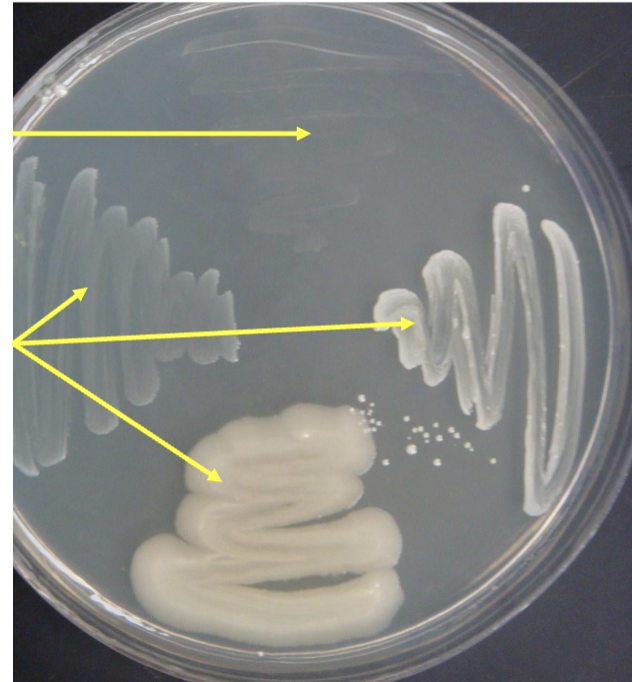 <p>if it grows it’s? bottom arrows staph. aureus</p>