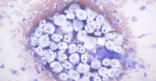 <p>What organism is this slide showing?</p>