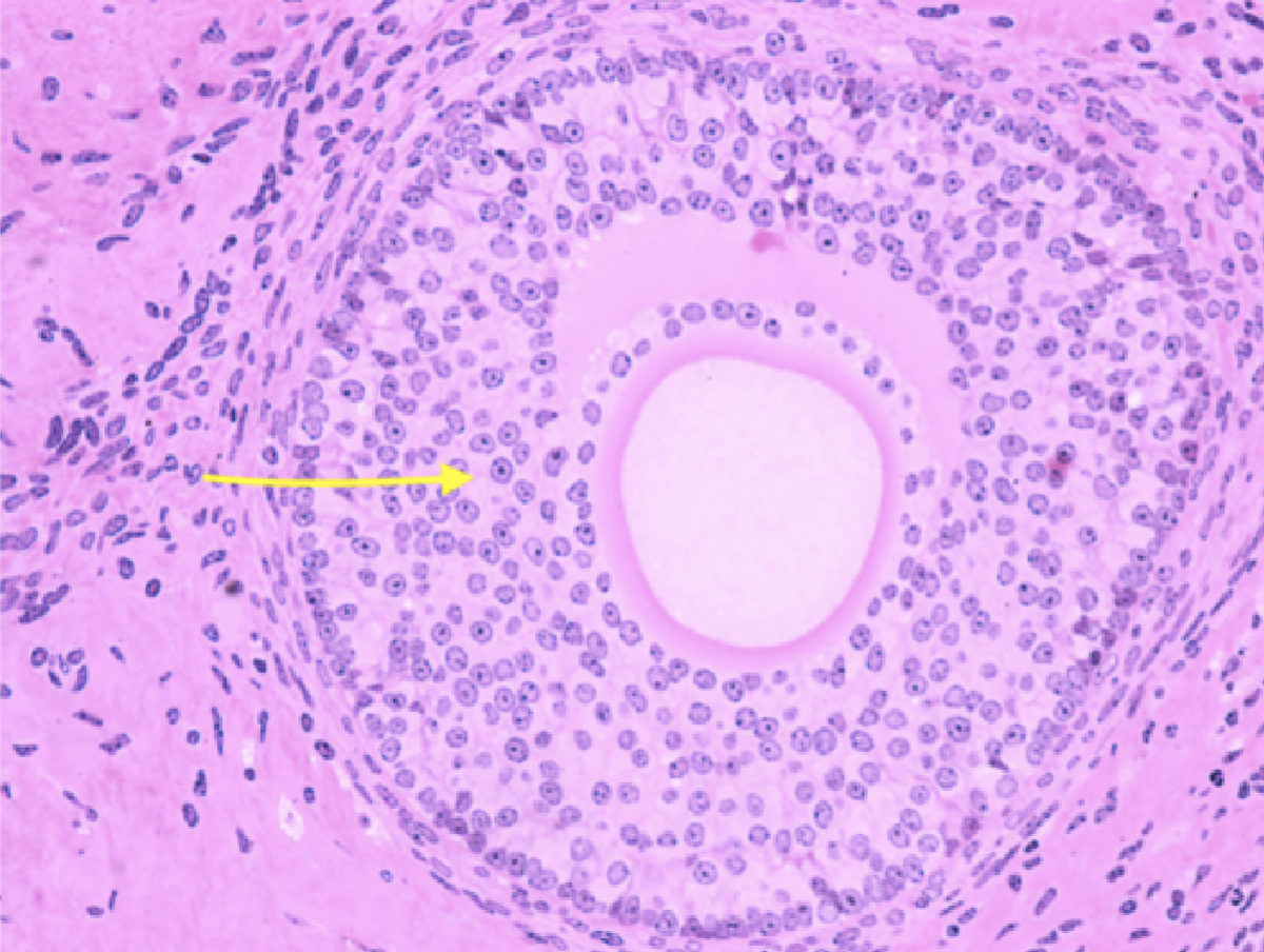 <p>Identify the layer</p>