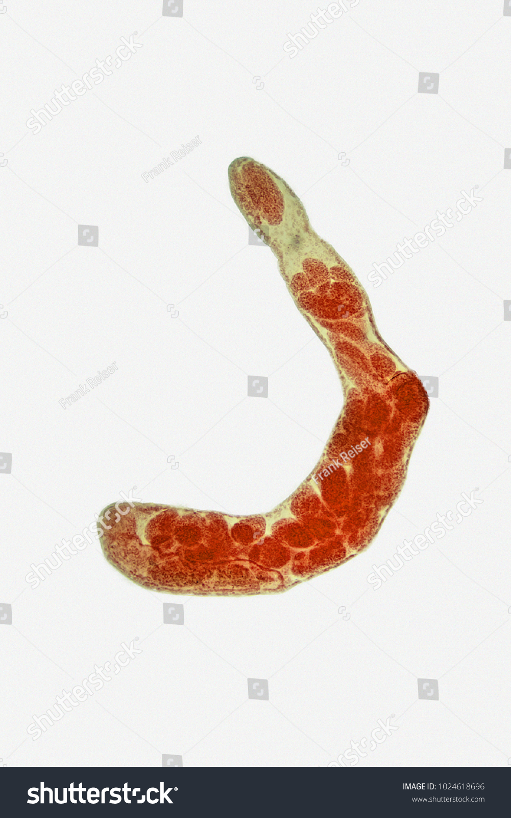 <p>Fasciola hepatica, Rediae, wm (Phylum Platyhelminthes, Subphylum Neodermata, Class Trematoda, Subclass Digenea, Family Fasciolidae). Note the mouth and pharynx. Contains developing cercariae. Found in intermediate host (mollusks).</p>