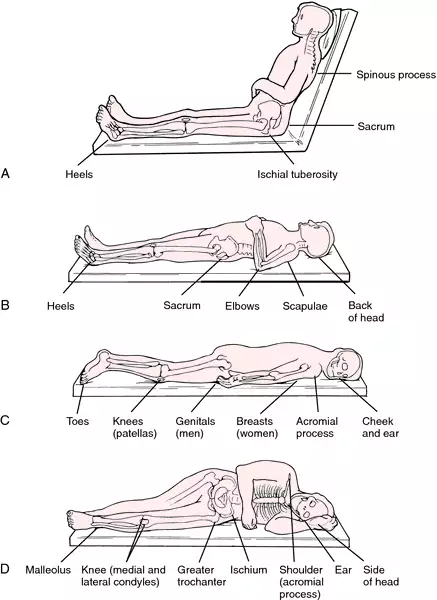 <p>Patient is lying on side. Looking for air filled/ fluid filled lungs. Use horizontal beams.</p>