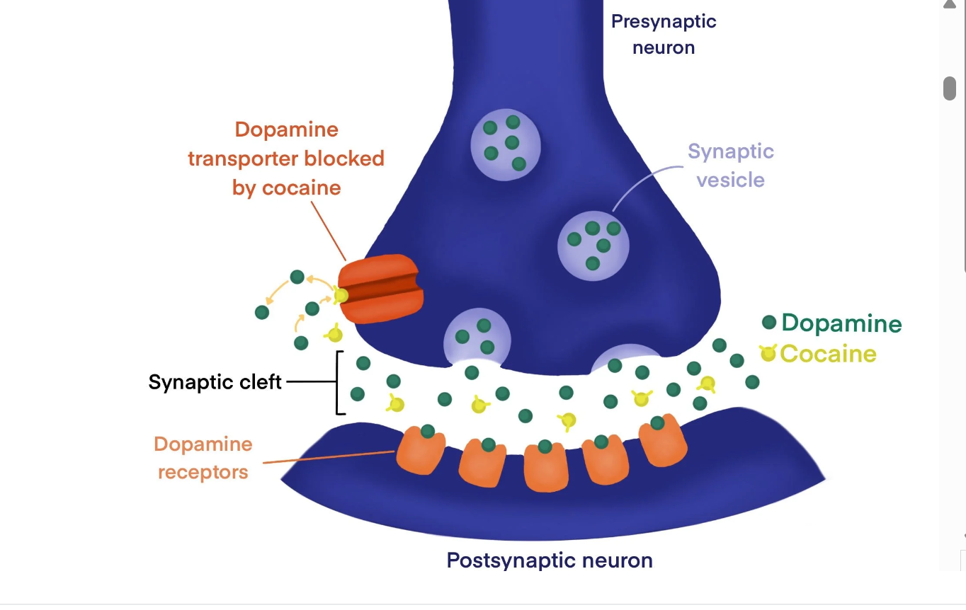 <p>dopamine transporter blocked by cocaine</p>